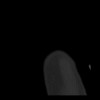 SPORK, NICO - 22.03.1976 - 02.08.2022 - CT obere Extremität - 17:58:51